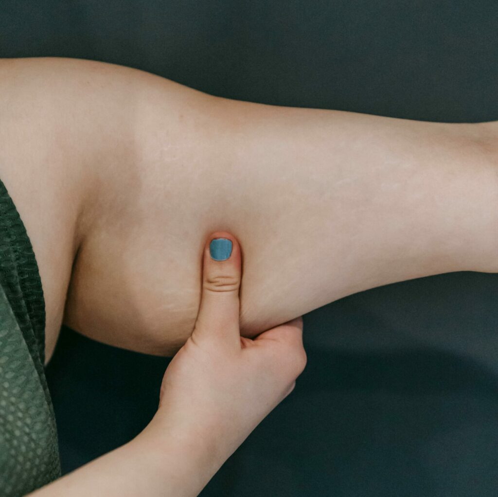 Melhores Exercício Para Tchauzinho Do Braço